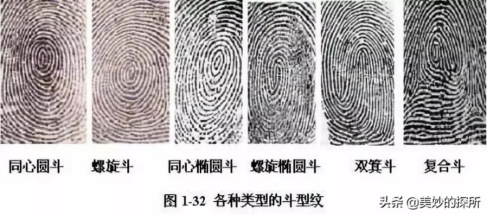 指纹是人体身份证，天生没有指纹的人，会成为“法外狂徒”吗？