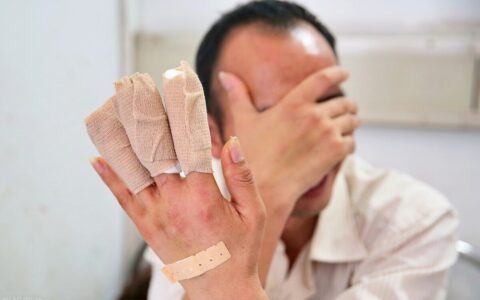 工伤认定程序和流程及工伤骨折赔偿标准一览表