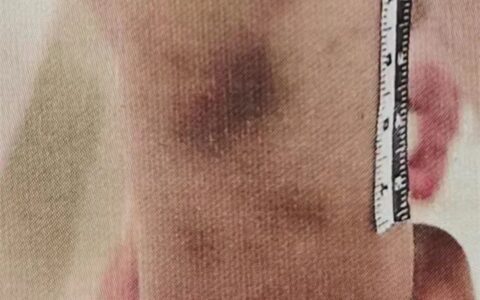 虐待罪怎么认定及虐童行为的认定