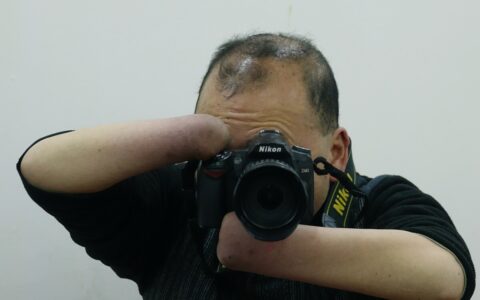 法医伤残鉴定标准及民事伤残鉴定标准及赔偿